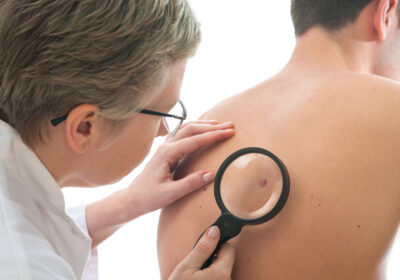 Basal Cell Carcinoma (BCC): Appearance and Treatments