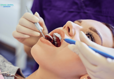 Top 4 Noteworthy Tips for Speedy Recovery after Root Canal Treatment