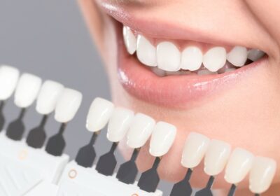 Transform Your Smile with Exceptional Zirconia Dental Restorations
