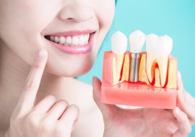 Dental Implants Melbourne: Restoring Your Smile with Confidence