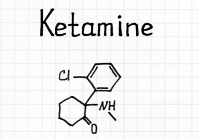 Ketamine Infusion Therapy: What to Expect During a Treatment Session?