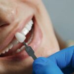 Achieving a Dazzling Smile: A Comprehensive Guide to Dental Veneers