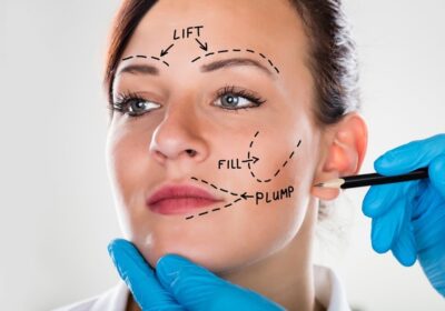 How to Prepare for a Facelift Procedure