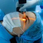 Cataract Medical surgery – All that you should know