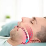 Sleep Apnea and Dentistry: How Dentists Can Help