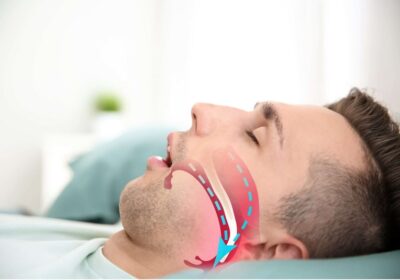 Sleep Apnea and Dentistry: How Dentists Can Help