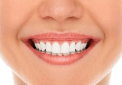 How Orthodontics Can Improve Your Smile