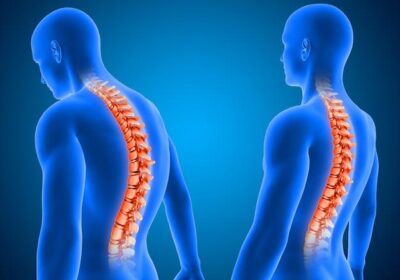 Why Chiropractic and Spinal Decompression are a Game-Changer for Chronic Pain Relief