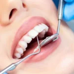 Top 5 Questions to Ask Your Family Dentist