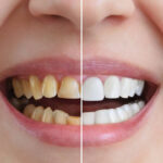 Transforming Smiles With Family And Cosmetic Dentistry Services