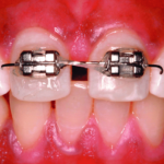 The Complete Guide To Orthodontics: What You Need To Know