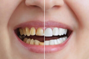 Transforming Smiles With Family And Cosmetic Dentistry Services