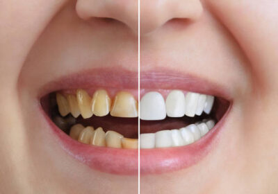 Transforming Smiles With Family And Cosmetic Dentistry Services