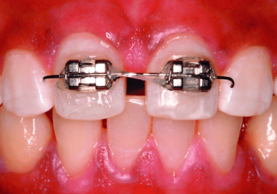 The Complete Guide To Orthodontics: What You Need To Know