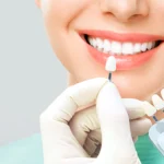 Best Dental Clinic for Full-Mouth Rehabilitation