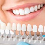 The Transformative Power of Cosmetic Dentistry: A Path to Your Dream Smile