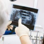5 Questions To Ask About Your Next Dental X Ray