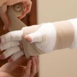 How to Control Lymphedema Fluid Build Up