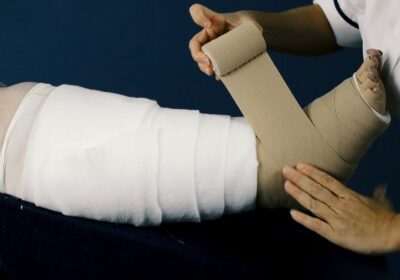 Lymphedema Treatment with Multi-Layered Compression Lymphedema Treatment with Multi-Layered Compression