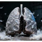 Understanding Pleural Mesothelioma And Its Link To Lung Cancer