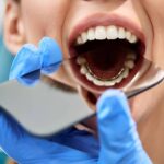 Understanding the Ins and Outs of Lingual Braces
