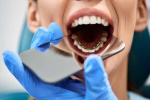 Understanding the Ins and Outs of Lingual Braces