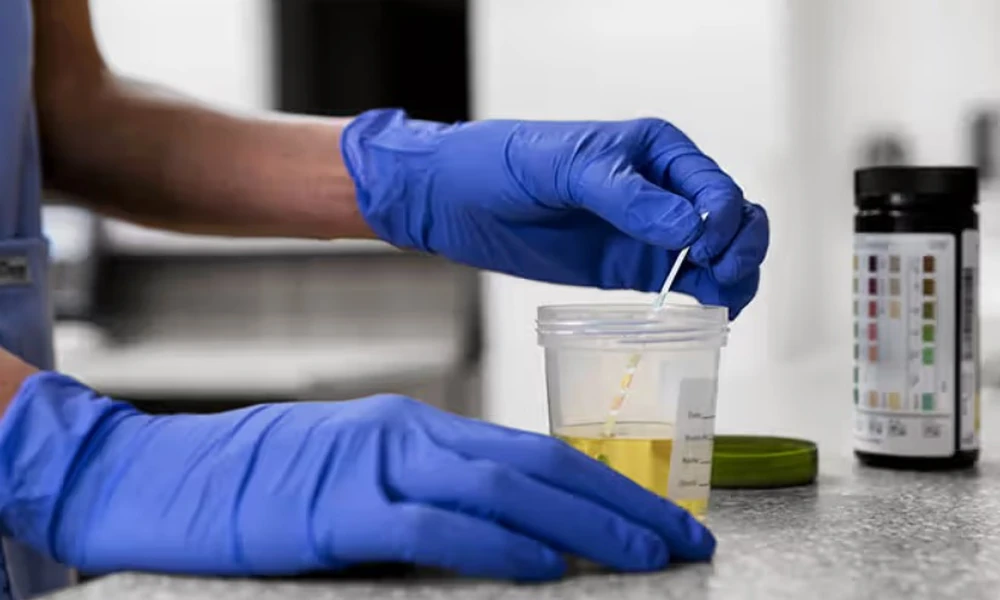 Things to Know Before Selecting Synthetic Urine Preparation Products